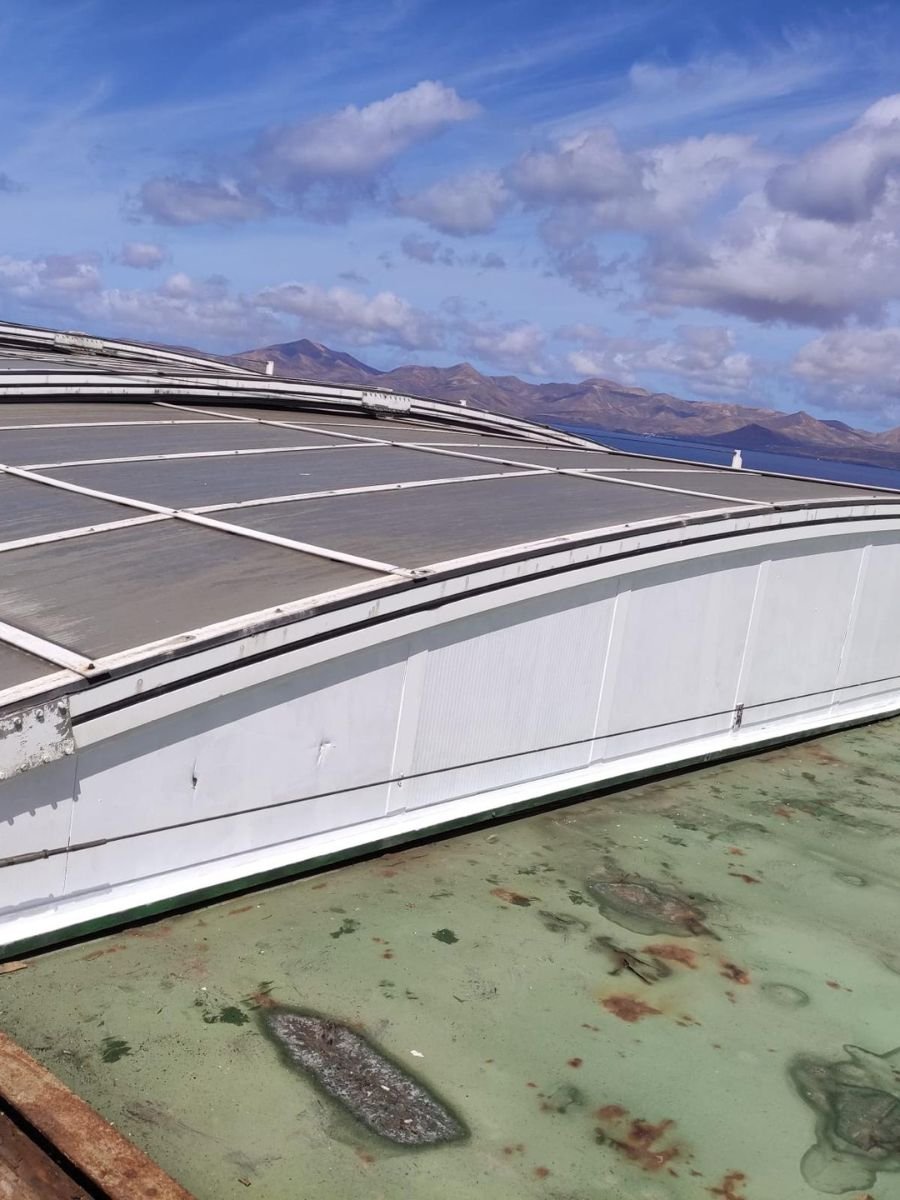 IBS - Antes y Despues (16)