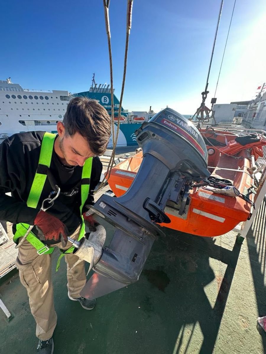 IBS - Antes y Despues (24)